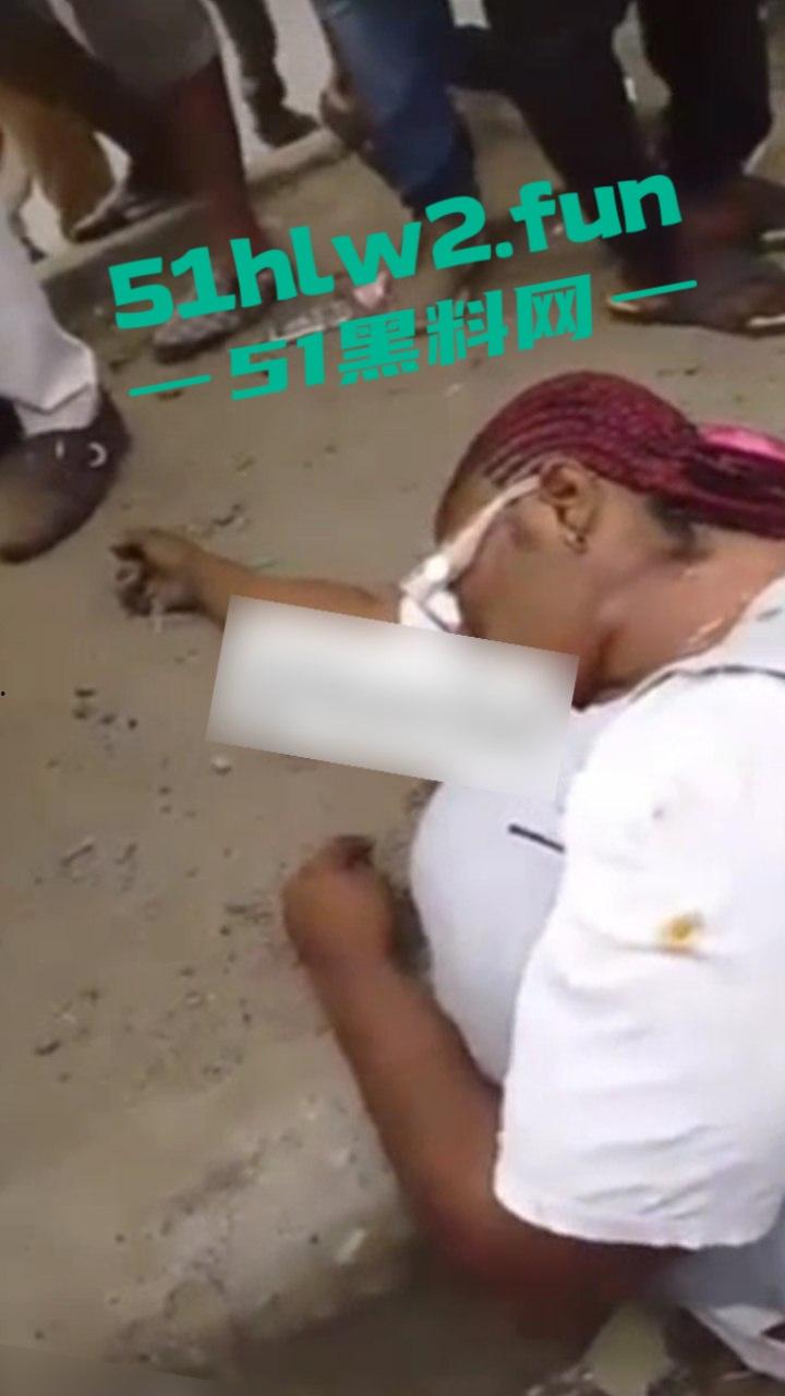 【血腥恐怖】尼日利亚重大车祸一妇女坐在货车前休息，由于视线盲区司机并未发现 将其碾压成两截。